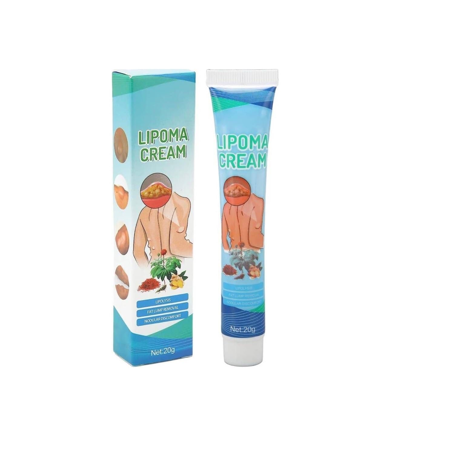 Buy ZYZHT 20g Lipoma Removal Cream: Gentle, User-Friendly Care