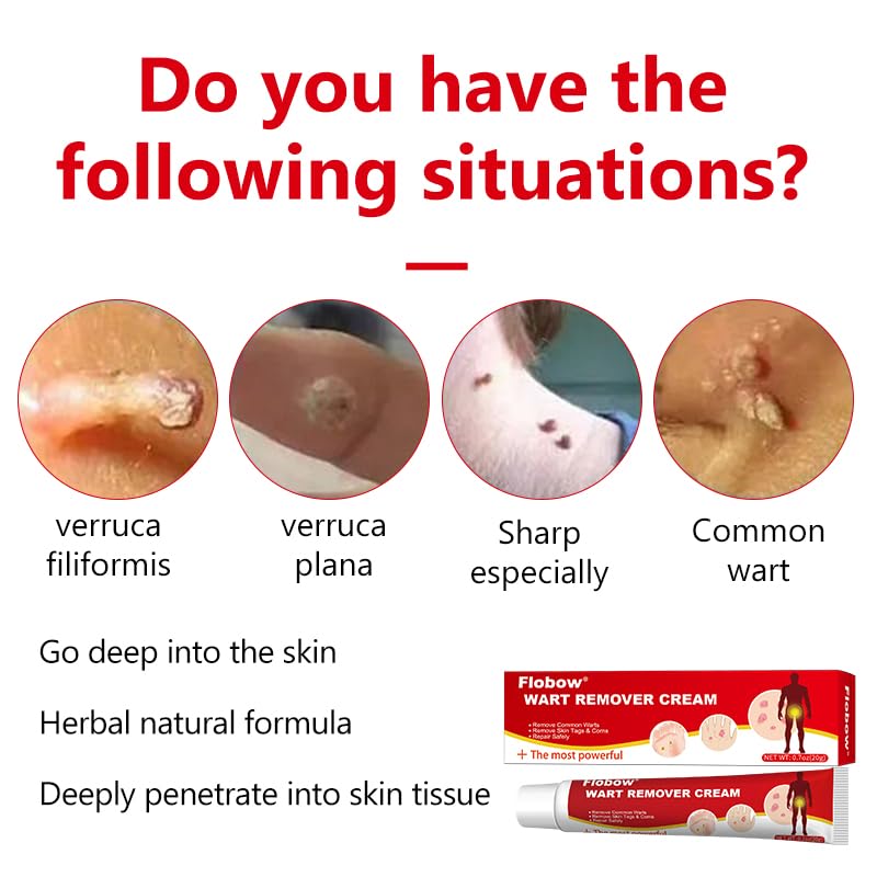Image of Wart Remover 20g, Effective Verruca Treatment, Corns Spot Moles, Moles and Calluses, Suitable for The Face and Body, Skin tag Remover, to Prevent The Spread of Wa