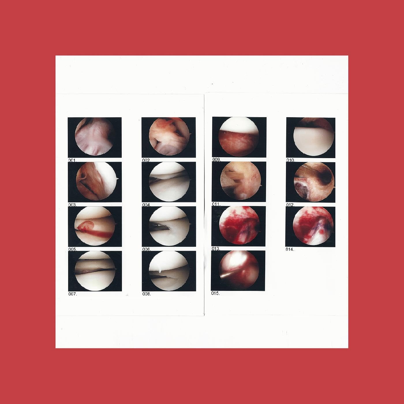 Laughing in My Sleep [VINYL]