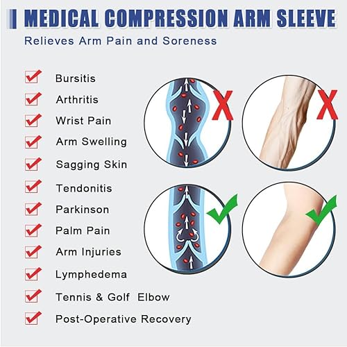 Miniatura 4 de beister Manga de compresión médica para linfedema con guante para hombres y mujeres (individual), soporte de brazo completo de 20-30 mmHg.