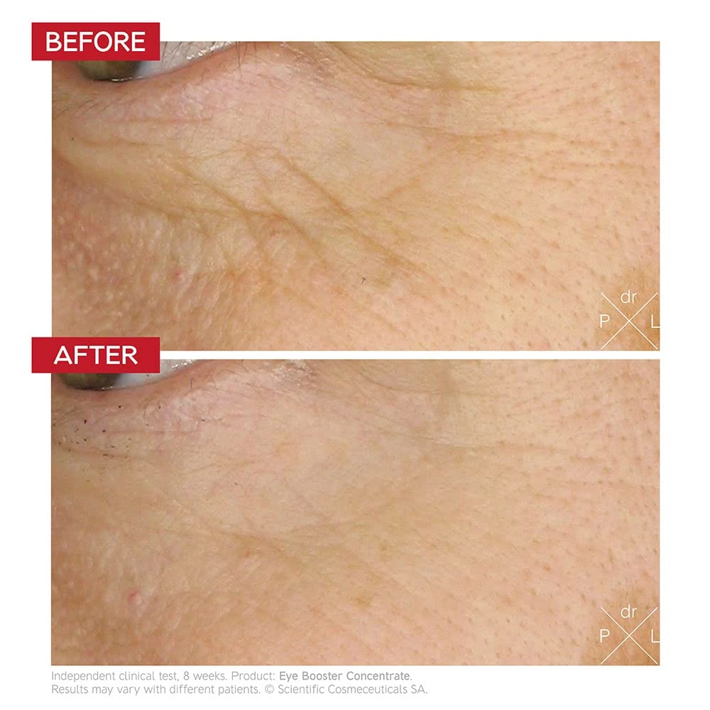 Dr. LEVY Eye Booster Concentrate (15ml) - Image 3