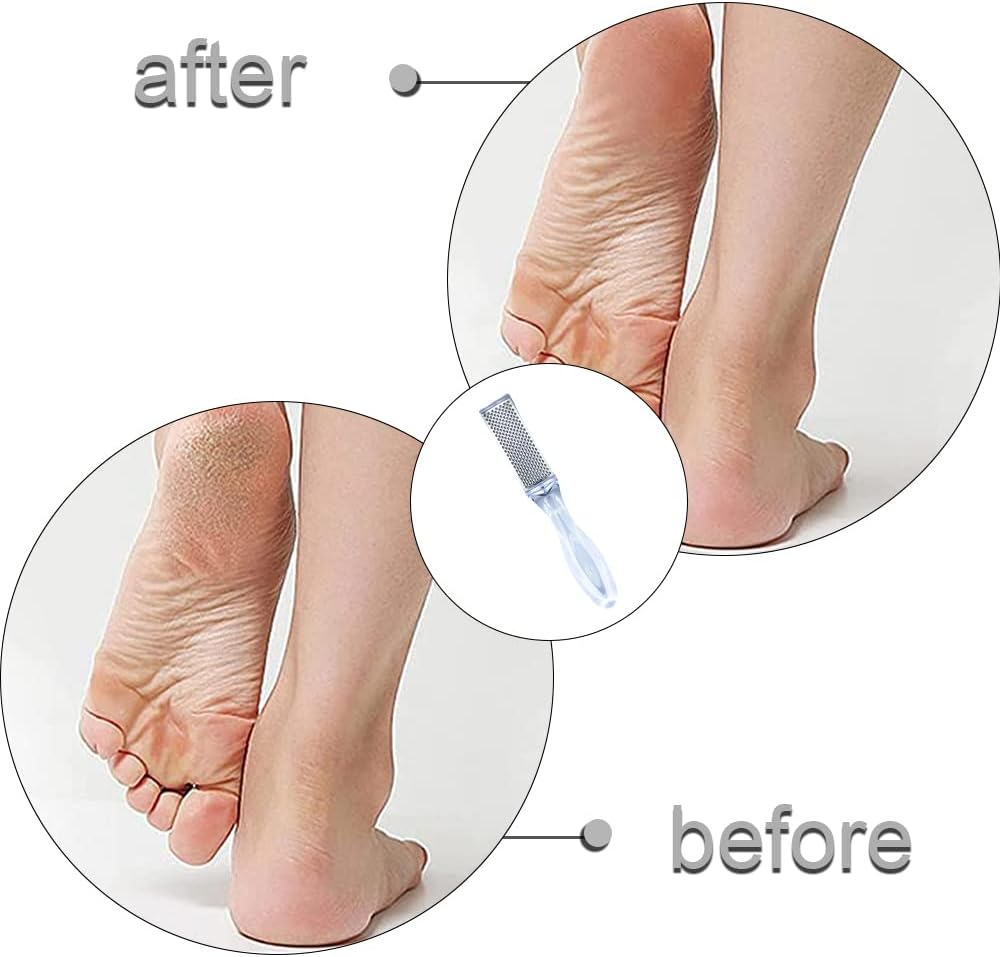 Pedicure File Double Sided Stainless Steel Feet Exfoliator Easy Grip Handle Foot Rasp File for Women Men Foot Care Dead Skin Dry Cracked