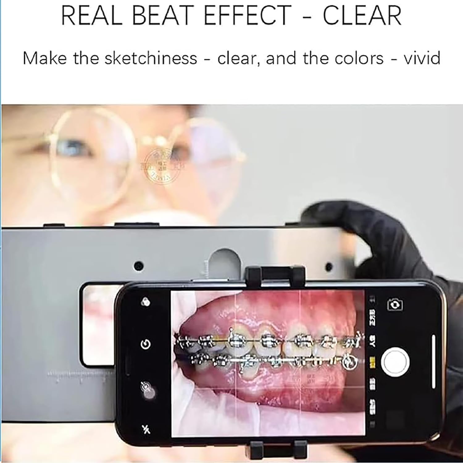 Kit di luci per fotografia dentale con luminosità regolabile per assistenza fotografica orale