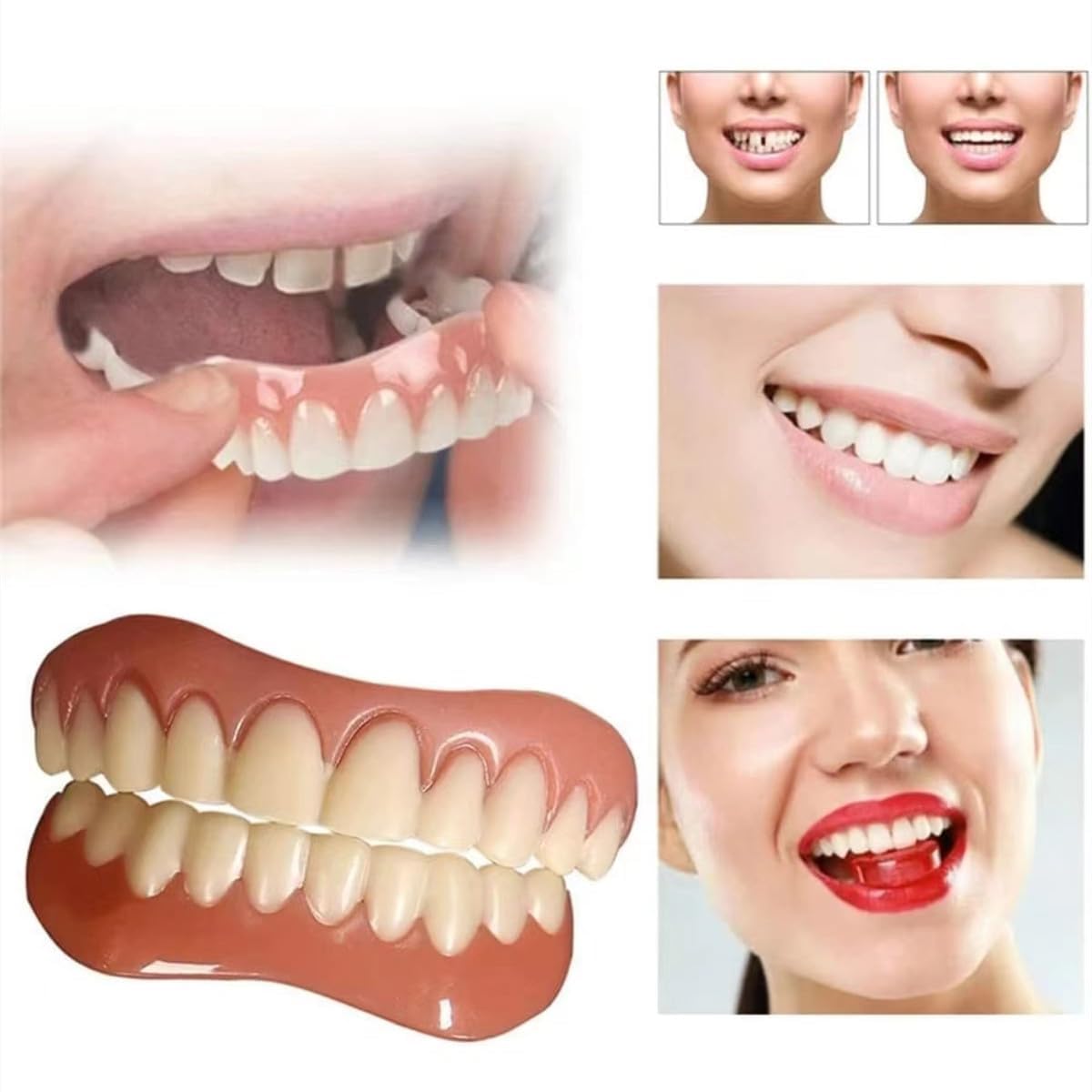 Dentiera Provvisoria Cosmetici 2 Paia Protesi Denti Removibili Denti Finti Da Applicare Da Soli Superiore E Inferiore, Faccette Dentali Estetiche Per Uomo Donna Sbiancante Denti Istantaneo