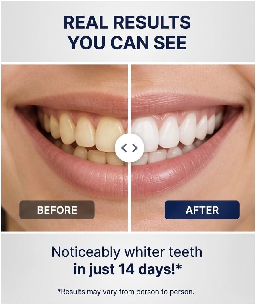 UniZone Professional Teeth Whitening Strips, Hydrogen Peroxide Formula, Enzyme-Powered Stain Removal, Non-Slip Dry Strips, Enamel Safe, 28 Count