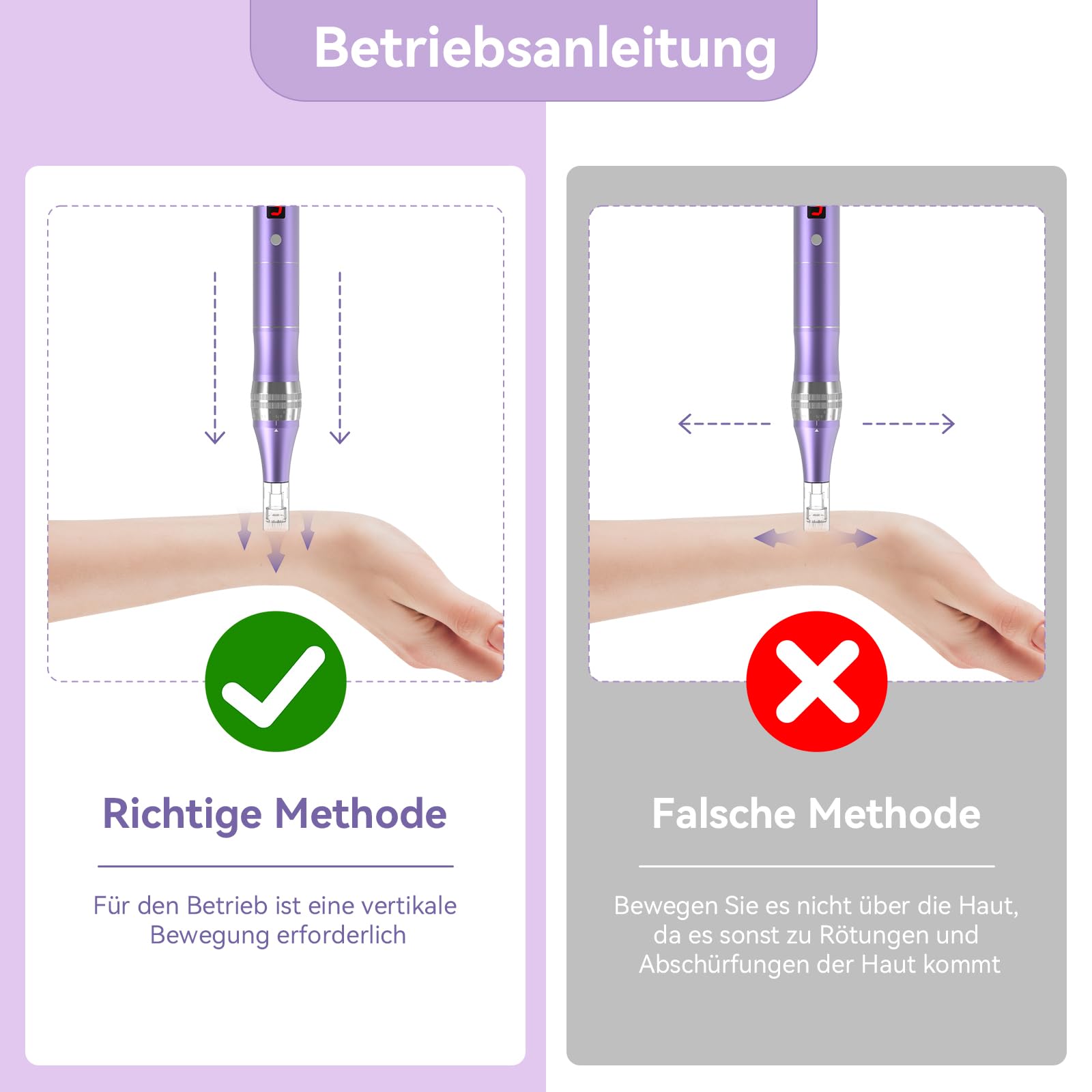 QUELLE Microneedling Pen Elektrisch,Kabellos Dermapen Microneedling mit LCD Bildschirm und 5 Stufen inkl.16 Patronen für Hautpflege