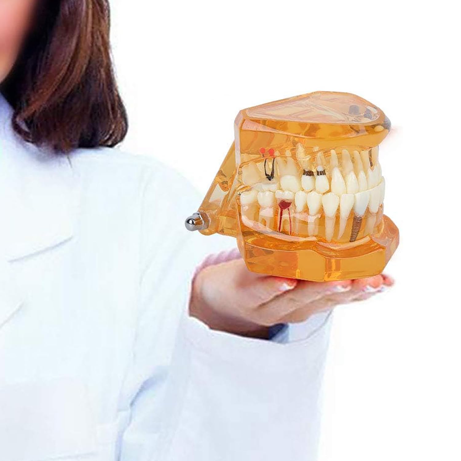 Pomarańczowy zdejmowany model zębów dentystycznych, model dentystyczny, nauczanie chorób zębów, model zębów implantologicznych, do komunikacji lekarz-pacjent