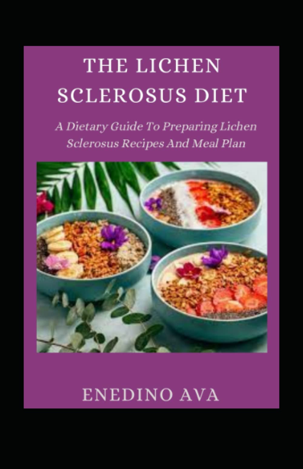 Buy The Lichen Sclerosus Diet A Dietary Guide To Preparing Lichen