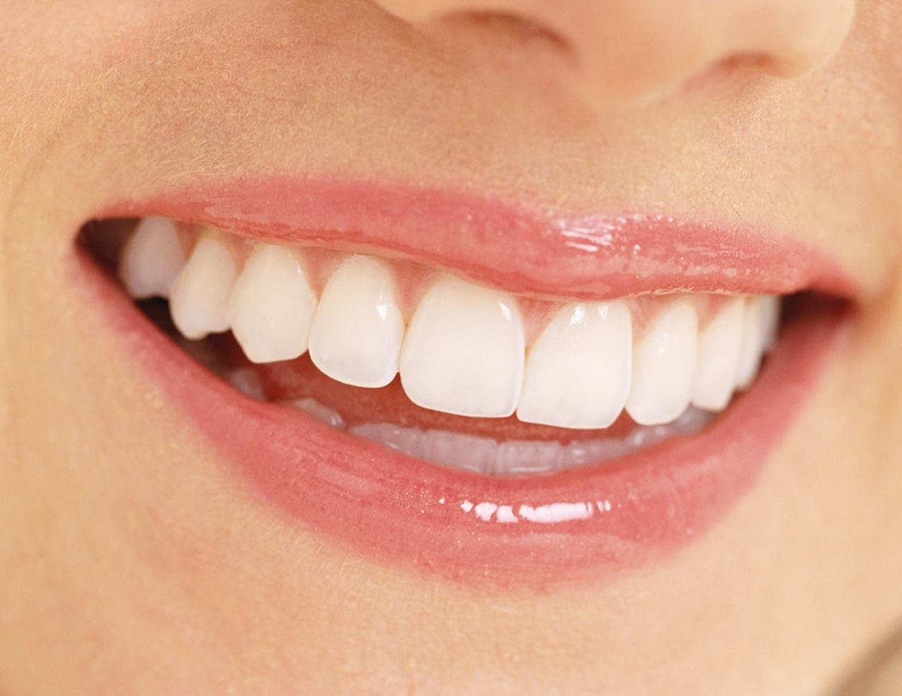 Opalescence GO 15% -Bonus Whitening Bundle with Mint Flavored Tooth Polish