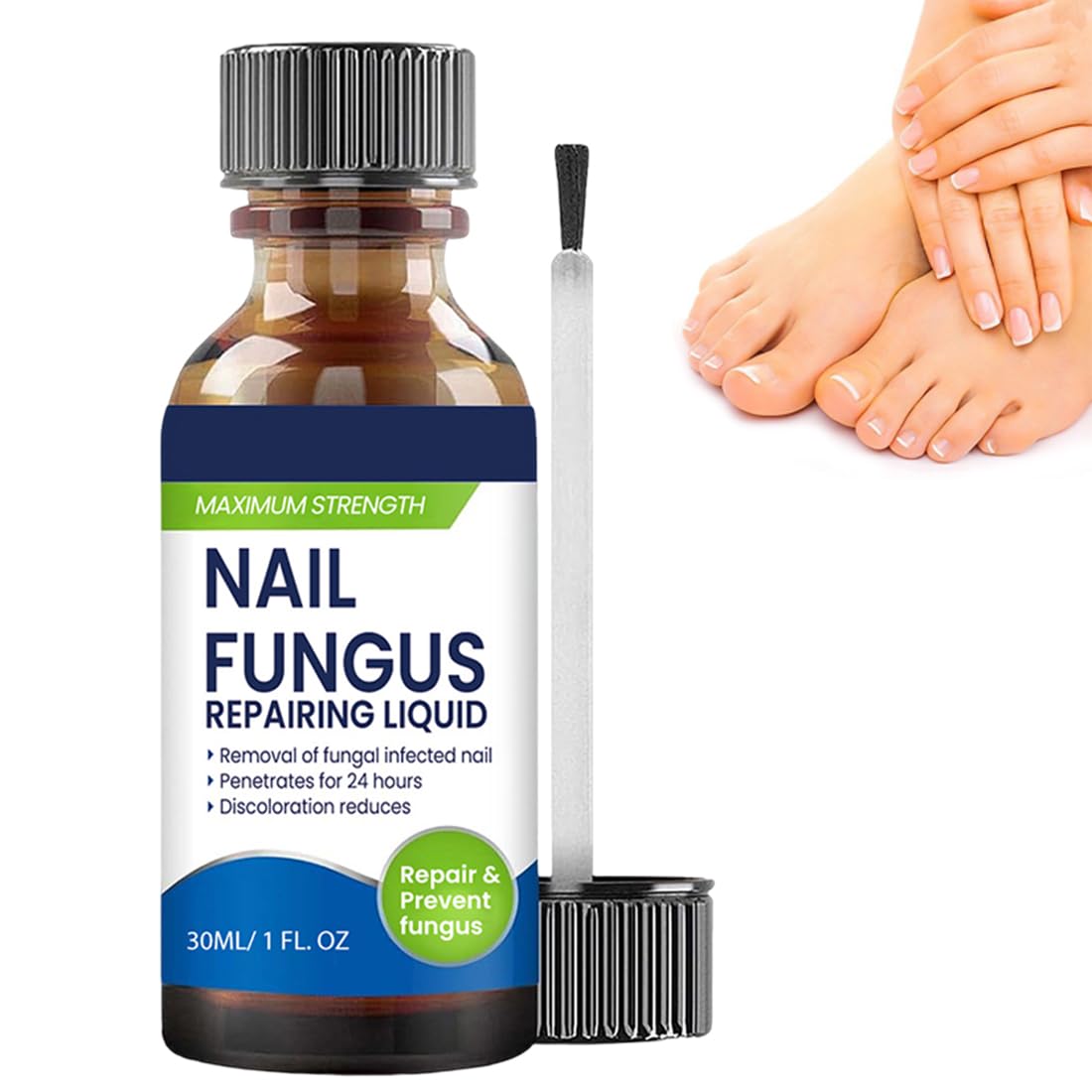 1 Pezzi Smalto Micosi Unghie Piedi con Formula Antimicotica Altamente Efficace, Previene la Recidiva di Funghi Unghie Piedi e Onicomicosi Unghie Piedi, Ideale per Micosi Unghie Piede Forte,B