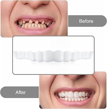 Wttfc False Teeth Veneers Top And Bottom Snap on Veneers Teeth Snap on Dentures False Teeth Veneers Missing Tooth Replacement Kit,Cosmetic Dentures for Men And Women,1 Pair [Energy Class A]