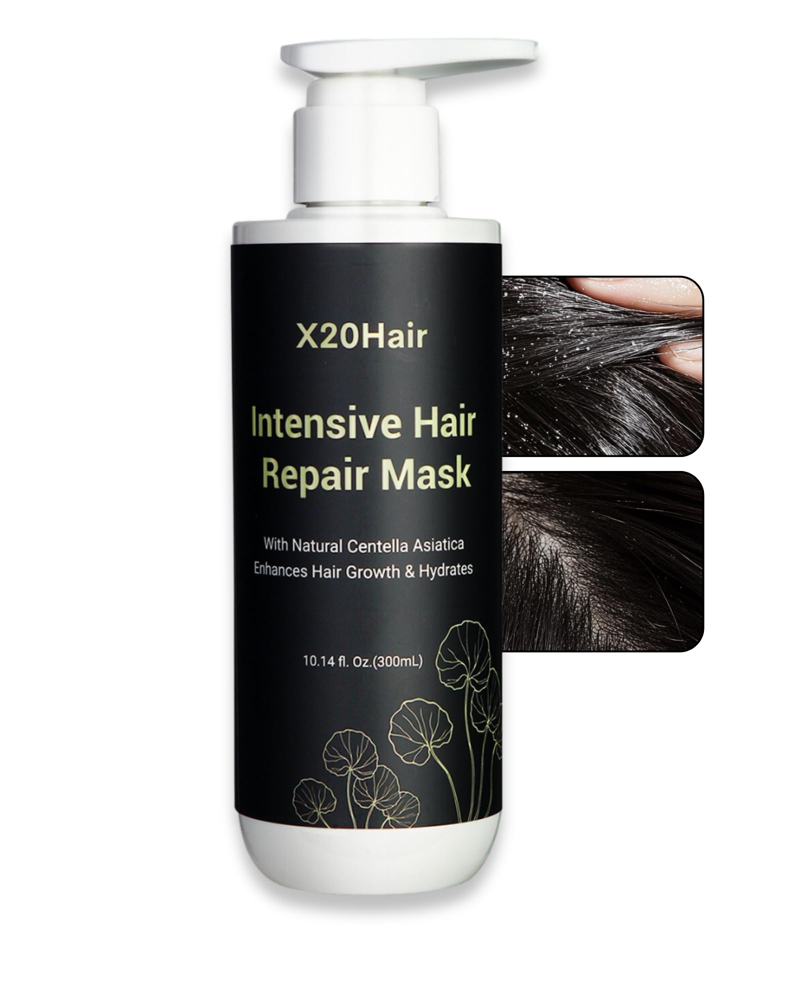 Dandruff Control Hair Mask - Deep Conditioning Treatment for Scalp Health & Strong Hair - Hydrolyzed Protein, Witch Hazel & Aloe Vera - All Hair Types - Paraben & Sulfate-Free – Ideal for Women