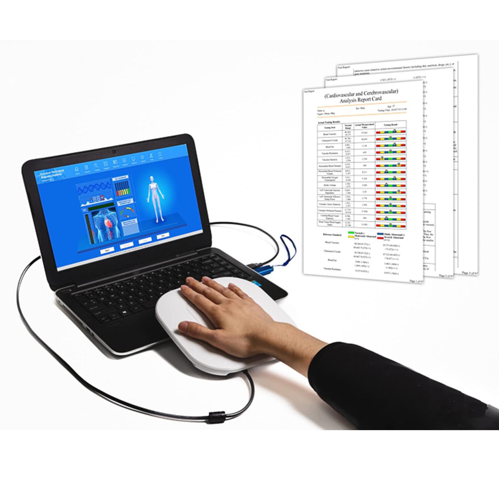 Analizzatore A Risonanza Magnetica Quantistica, Test Quantistico Professionale Portatile per Il Corpo, Analisi A Contatto con La Mano, Multilingue, Rapporto di 52 Voci