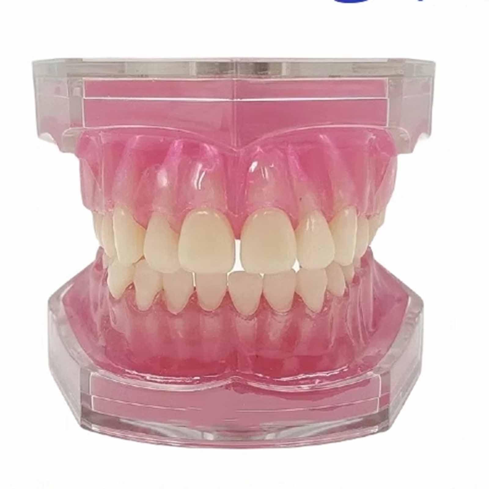 Model Demonstracyjny Zębów Dentystycznych, Model Z Wyjmowanymi Miękkimi Dziąsłami Do Nauki, Model Dydaktyczny Dla Dorosłych (Różowy, 8 Cm),Pink-8cm