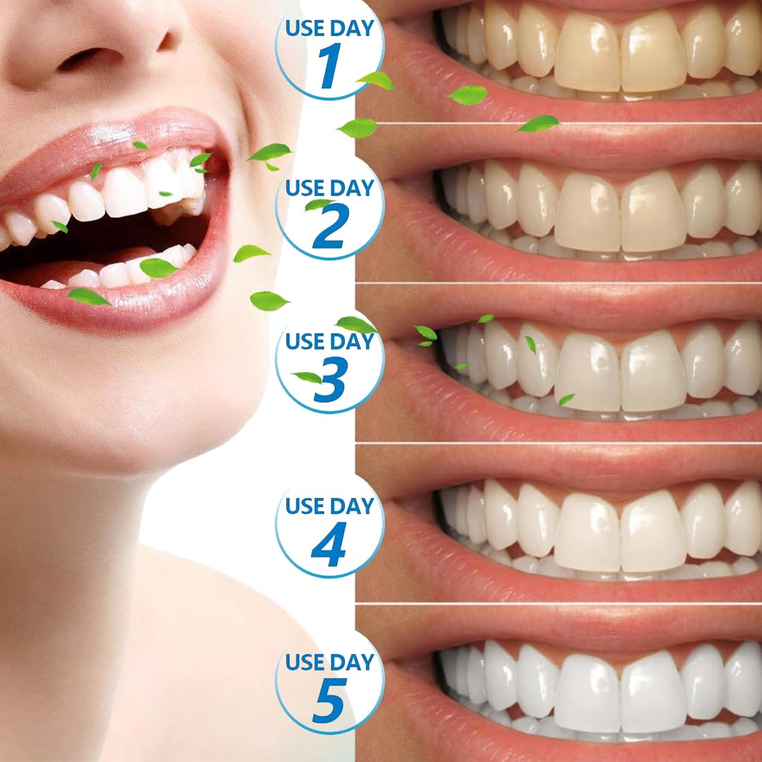 Strisce Sbiancanti Denti Professionale - 28 Strips Whitening per Sbiancamento,strisce sbiancanti denti, Delicate e Rapide, Rimuove le Macchie Profonde-A