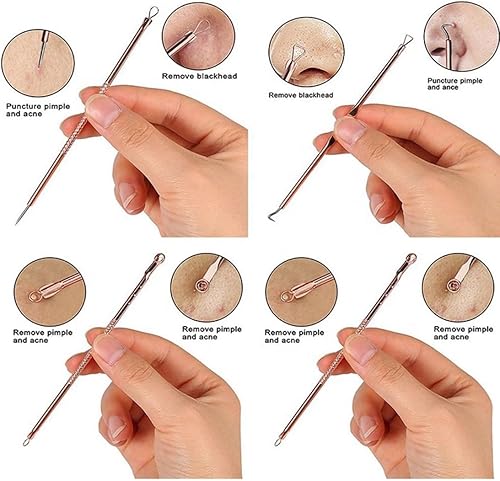 Miniatura 3 de Herramienta extractor de espinillas y comedones, el mejor kit de eliminación de acné, tratamiento para imperfecciones, estallidos de puntos blancos,