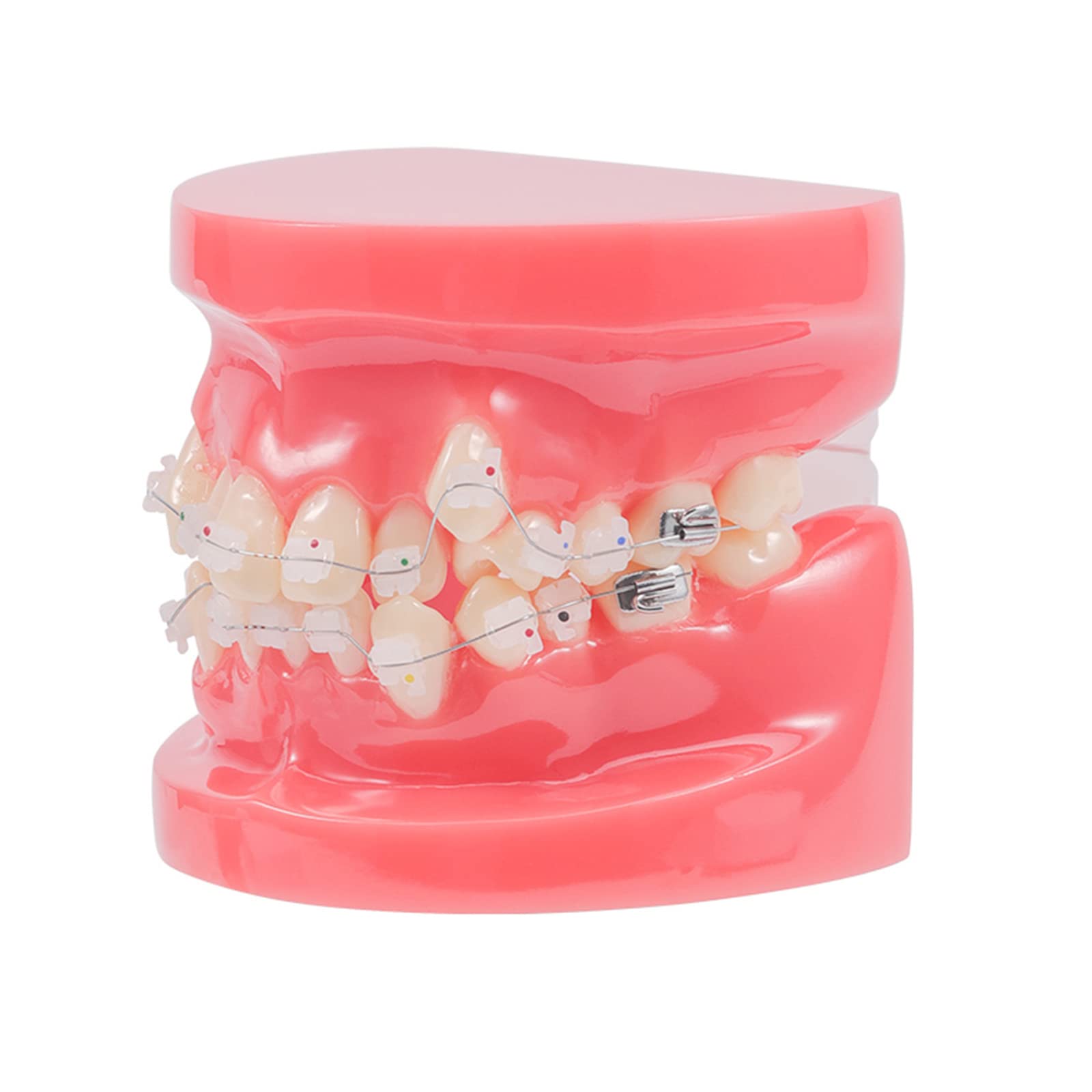 Model zębów dentystycznych-model demonstracyjny ortodoncji-dentystyczny z metalowymi wspornikami model zębów ortodontycznych do celów edukacyjnych nauka narzędzie dydaktyczne(A) (A)