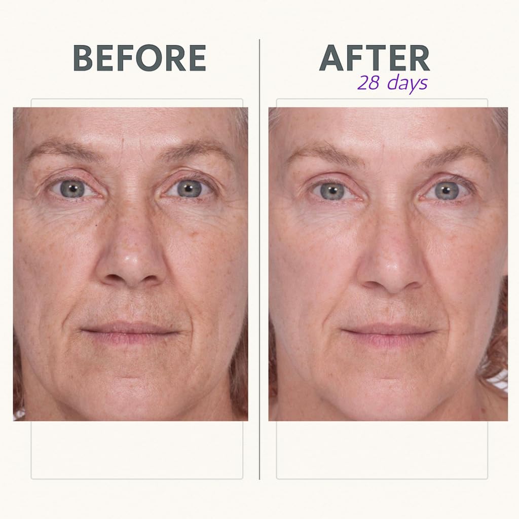 Reverse Lift Firming Facial Serum, Visibly Firm, Tone & Tighten Skin, Hydrating Anti-Aging Peptides, Reduce Wrinkles, Sagging Face and Neck, Serious Skincare, 1 oz - Image 4