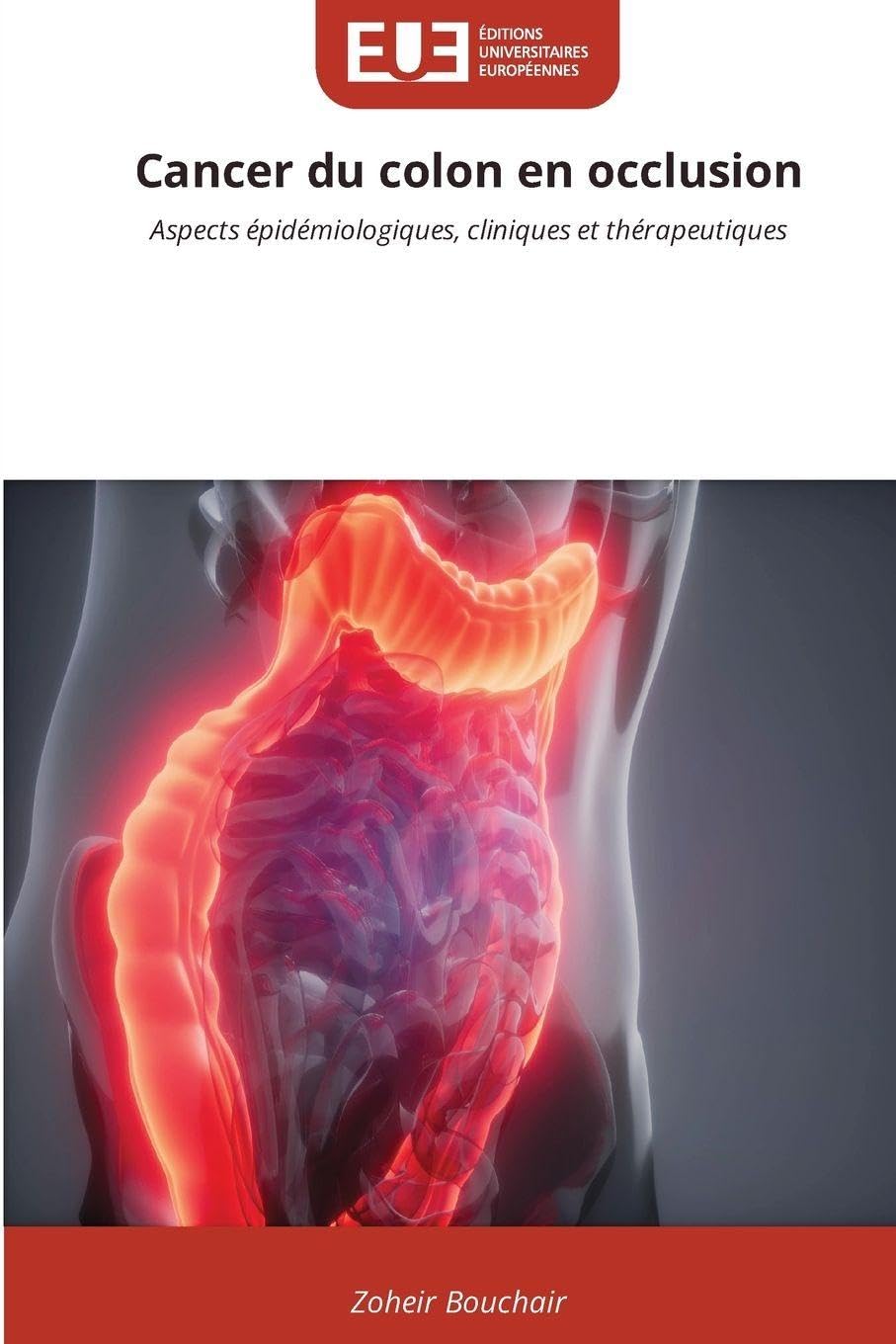 Cancer du colon en occlusion: Aspects épidémiologiques, cliniques et thérapeutiques