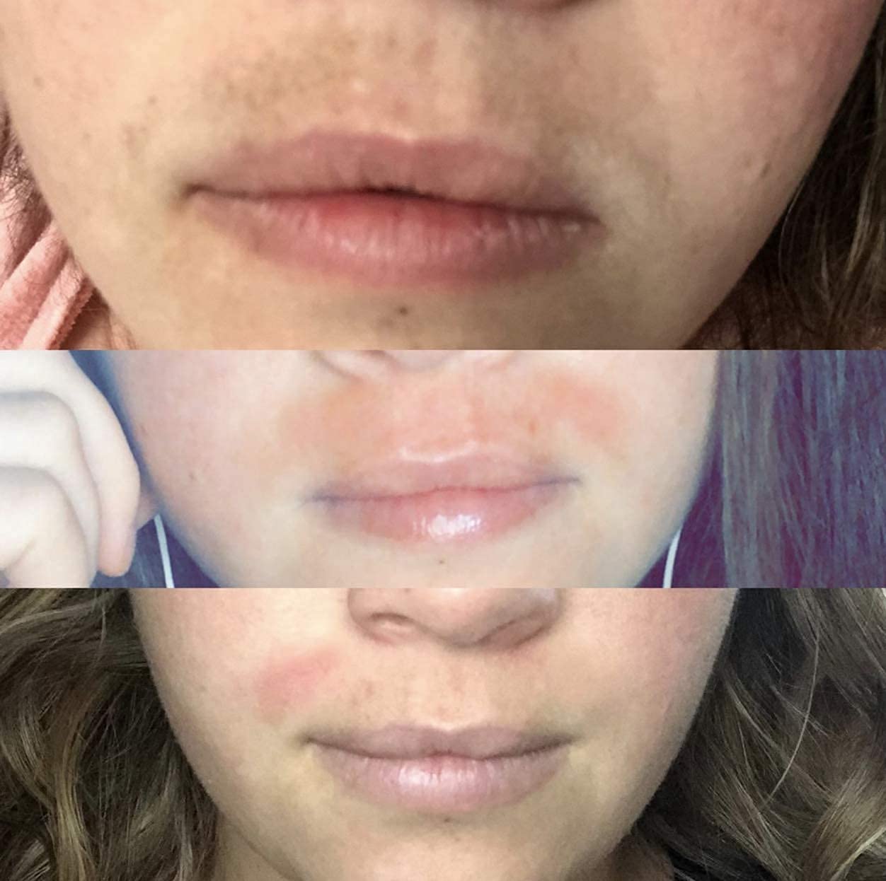 2 Hydroquinone Dark Spot Corrector Remover Brightening Serum, Skin