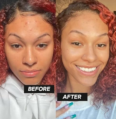 Zl Skin Guard & Glow Organic Face Mist Hydrating Spray With Vitamin C + Tremella Mushroom + Green Tea, Moisturizing Facial Mist Spray With Antioxidants To Rejuvenate & Soothe All Skin Types (4 Fl Oz) #TOP4