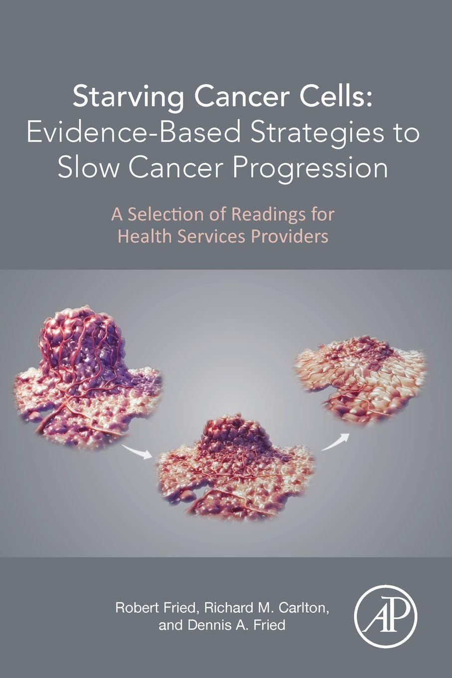 Starving Cancer Cells: Evidence-Based Strategies to Slow Canc... - 9780128240137