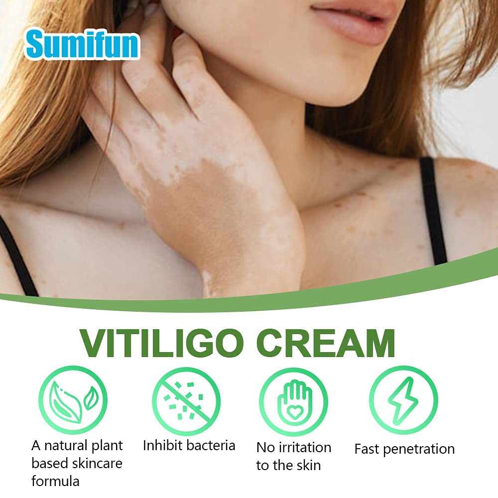 Sumifun Vitiligo Cream, Vitiligo Care Cream, Pigmentation regulating