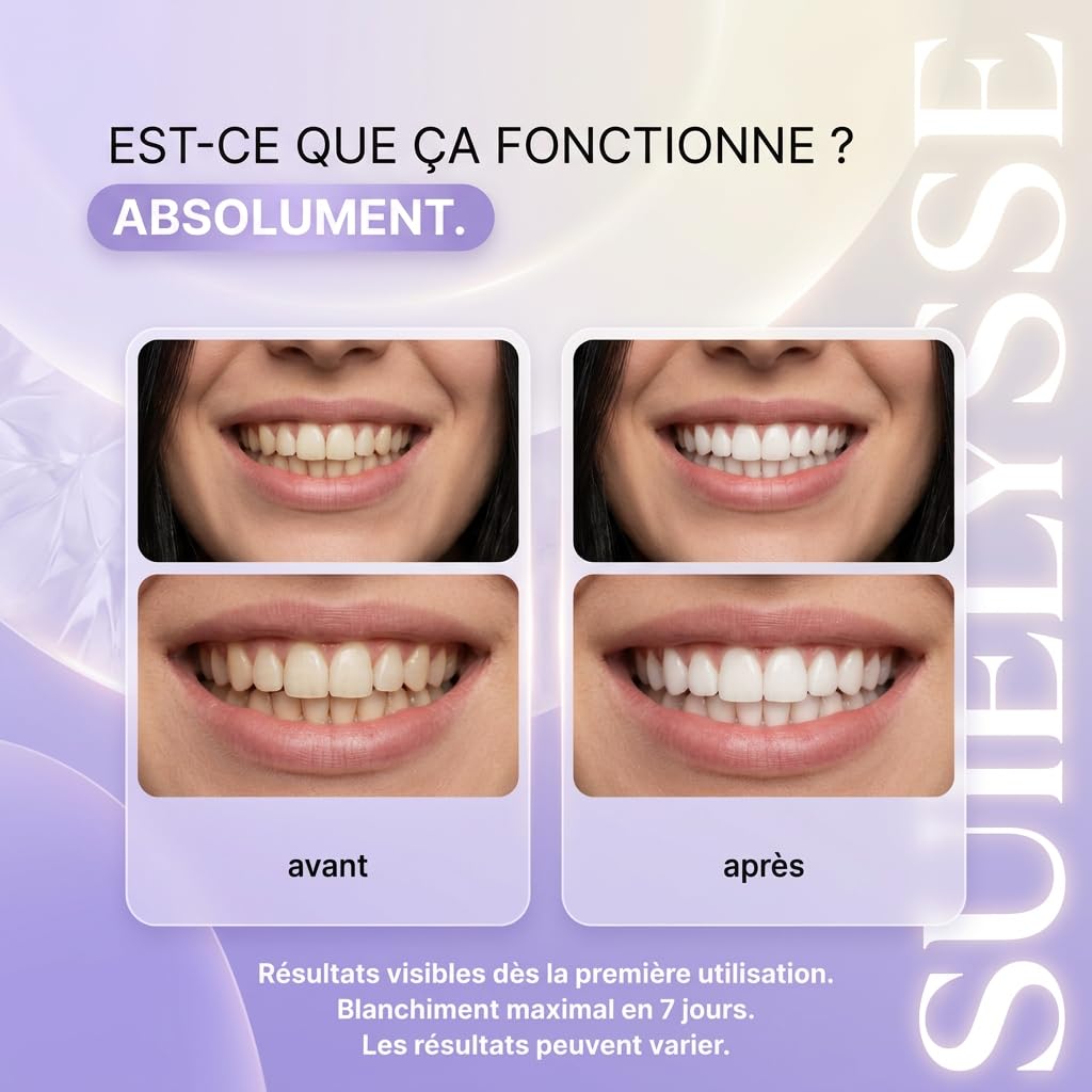 DrDent PURPLE WHITENING STRIPS, Bande Blanchiment Dentaire Violet sans Peroxyde, 42 Bandes Blanchissantes Dents avec Formule PAP+ pour un Sourire Éclatant à la Maison (1 Stück - 14pc)