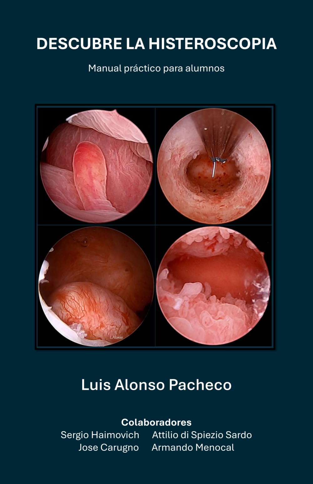 DESCUBRE LA HISTEROSCOPIA: Manual práctico para alumnos