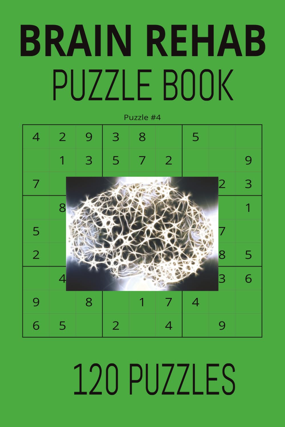 Brain Rehab puzzle book: A Gentle Cognitive Rehab Program to Rebuild Focus, Memory, and Mental Clarity A Relaxing Sudoku Journey to Calm the Mind and Strengthen Thinking Skills