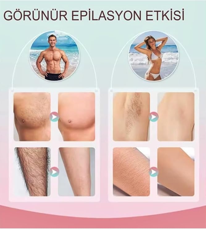 Kadın-Erkek IPL Buz Lazer Epilasyon Ağrısız Tüm Bölge Profesyonel Lazer Epilasyon Aleti 900.000 Atım