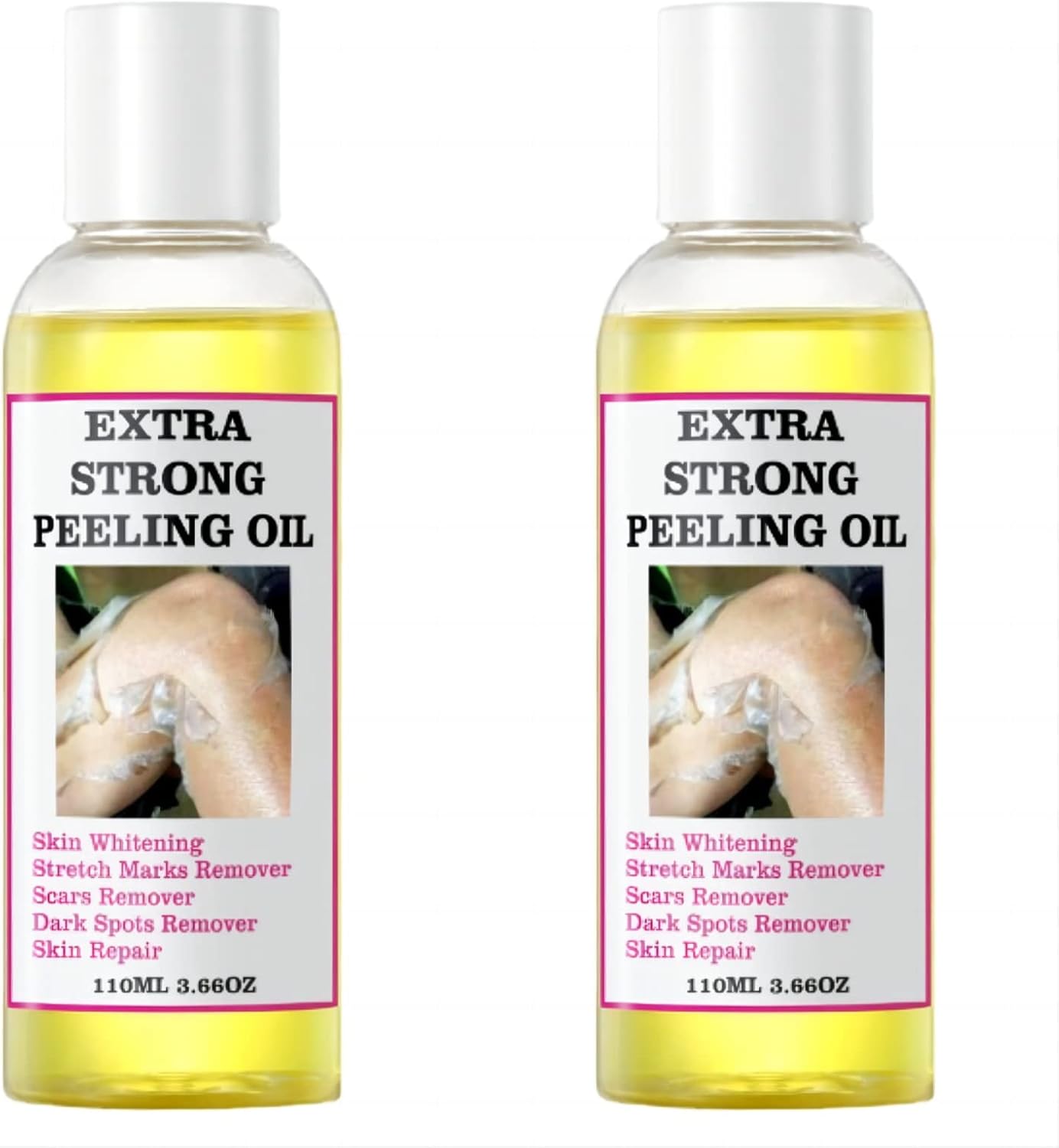 Extra Strong Peeling Oil, Yellow Peeling Oil for Dark Skin, Natural Formula Exfoliating Peels Solution for Face, Body, Hands and Foot Dead Skin Remover