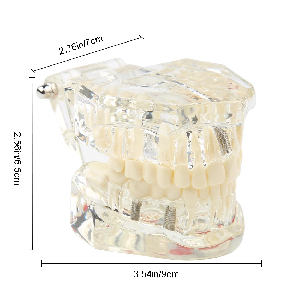 Dental Transparent Disease Teeth Model, Clear | Implant Teeth Model, Removable Crown Bridge, Analysis Demonstration, Student Education Training