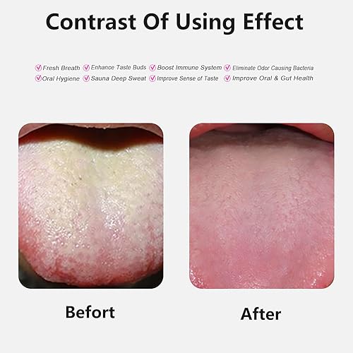 Miniatura 4 de Raspador de lengua, limpiador de lengua de acero inoxidable con estuche de almacenamiento de metal, limpiador de lengua para aliento fresco e