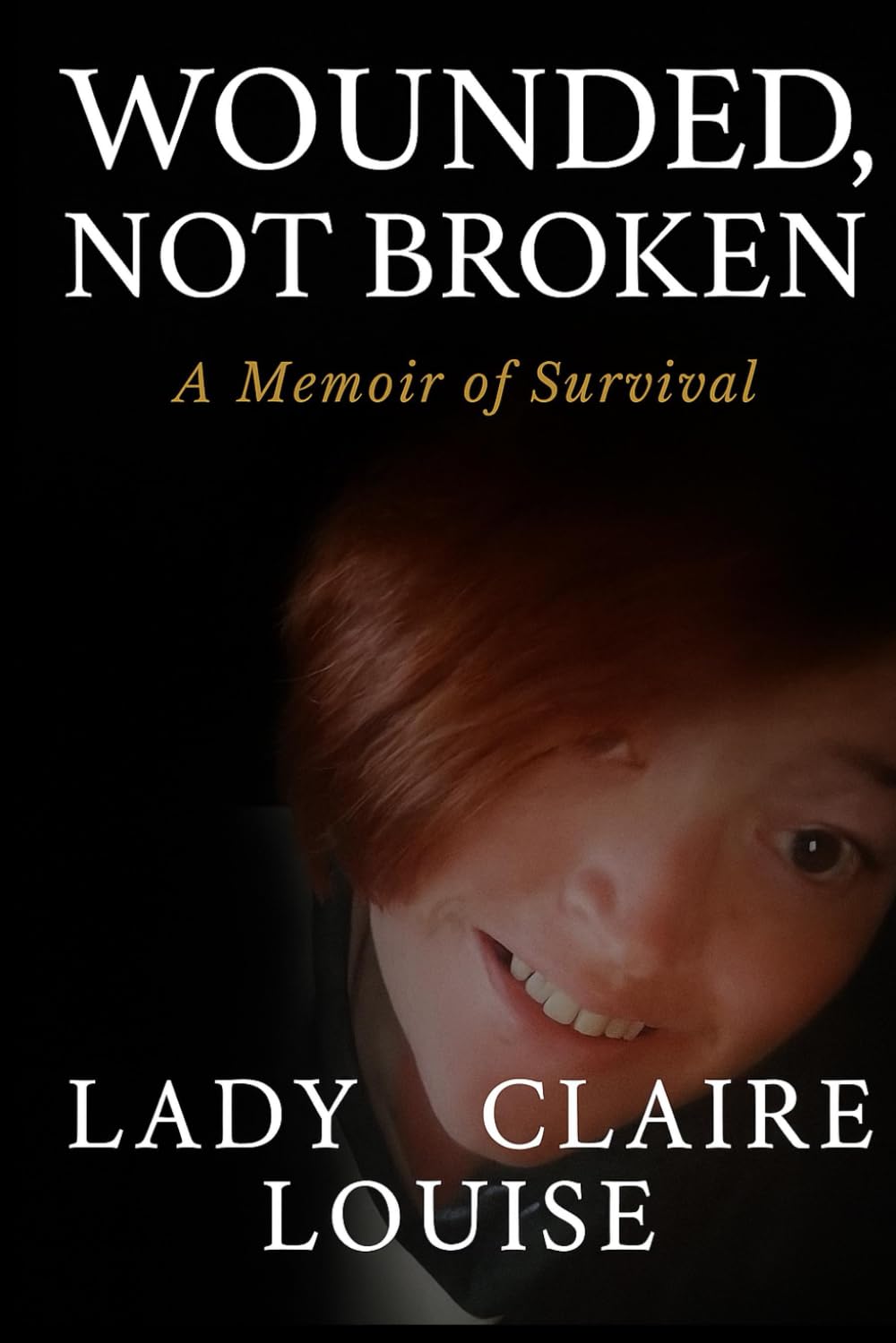 Wounded, Not Broken: A Memoir of Survival