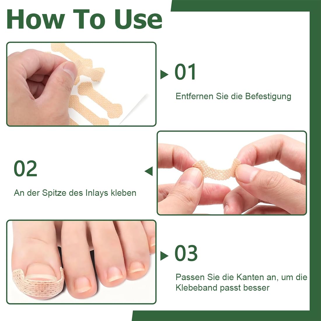 80 Piezas Korrección de Uñas Encarnadas, Parche Corrector de Uñas de los Pies,Parche de Corrección de Uña Encarnada Elástico, Pegatinas de Uñas Encarnadas, para Mujeres y Hombres