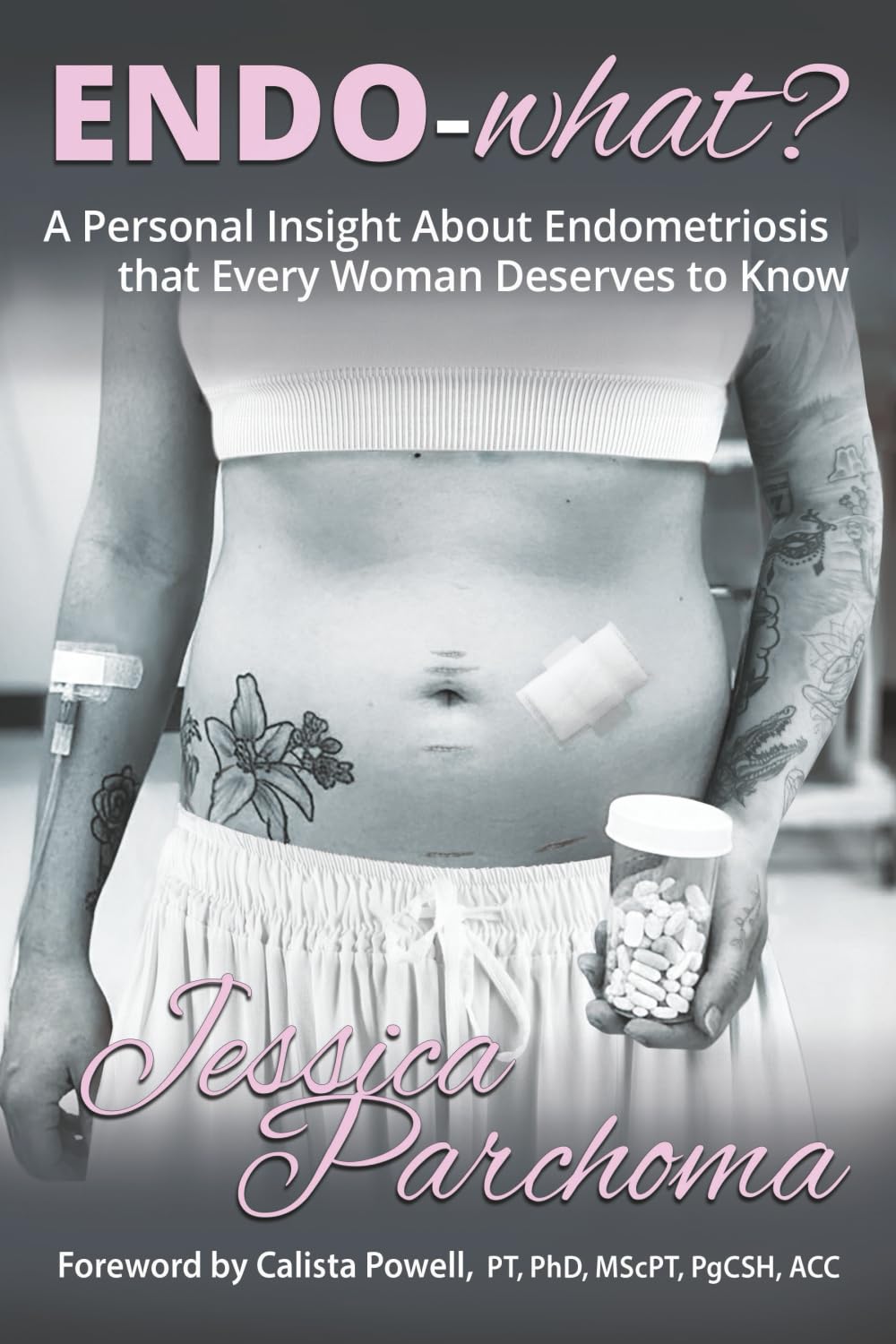 Endo-what?: A Personal Insight On Endometriosis That Every Woman Deserves To Know
