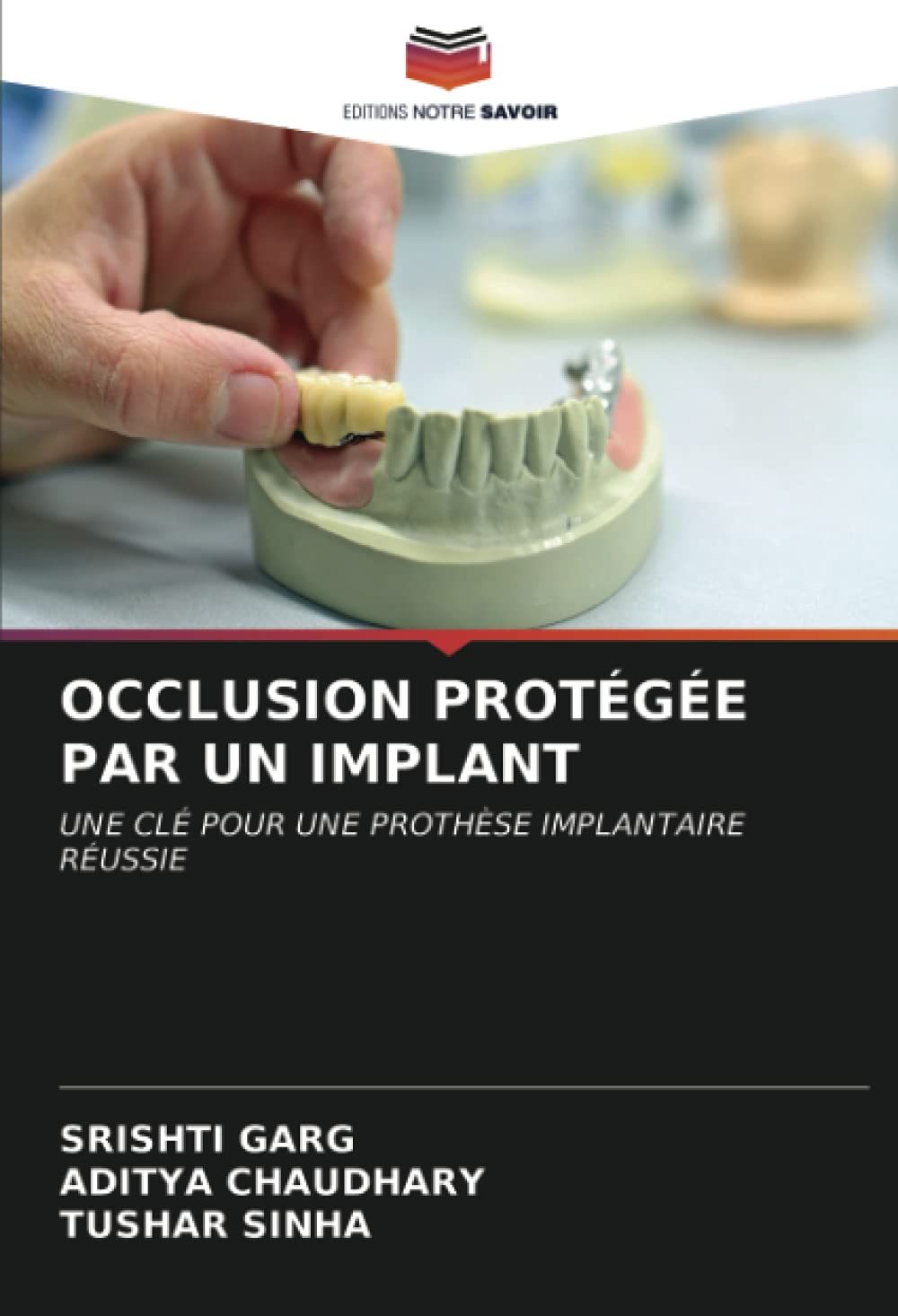 Buy OCCLUSION PROTÉGÉE PAR UN IM UNE CLÉ POUR UNE PROTHÈSE IMAIRE