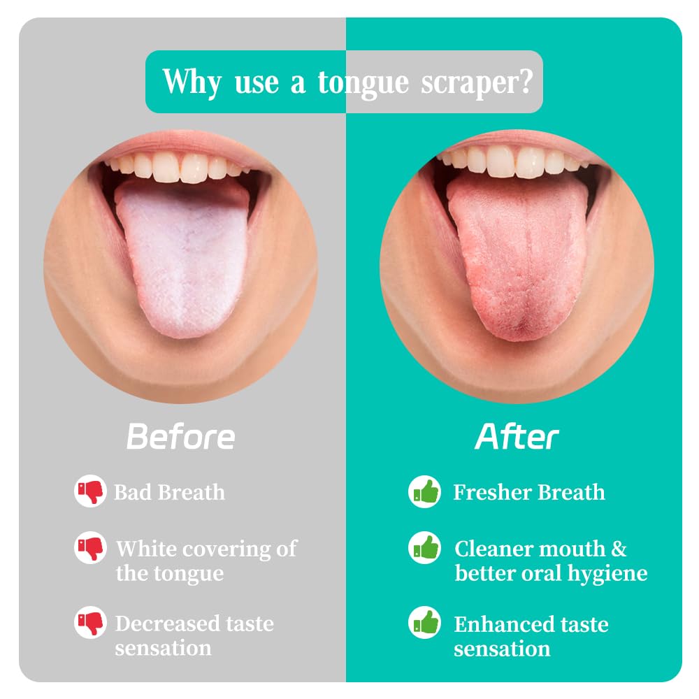 VIWIK Paquete de 6 raspadores de lengua de acero inoxidable, sin BPA, fácil de usar, suave con la lengua, promueve el aliento fresco y la higiene bucal, duradero, resistente al óxido, adecuado para