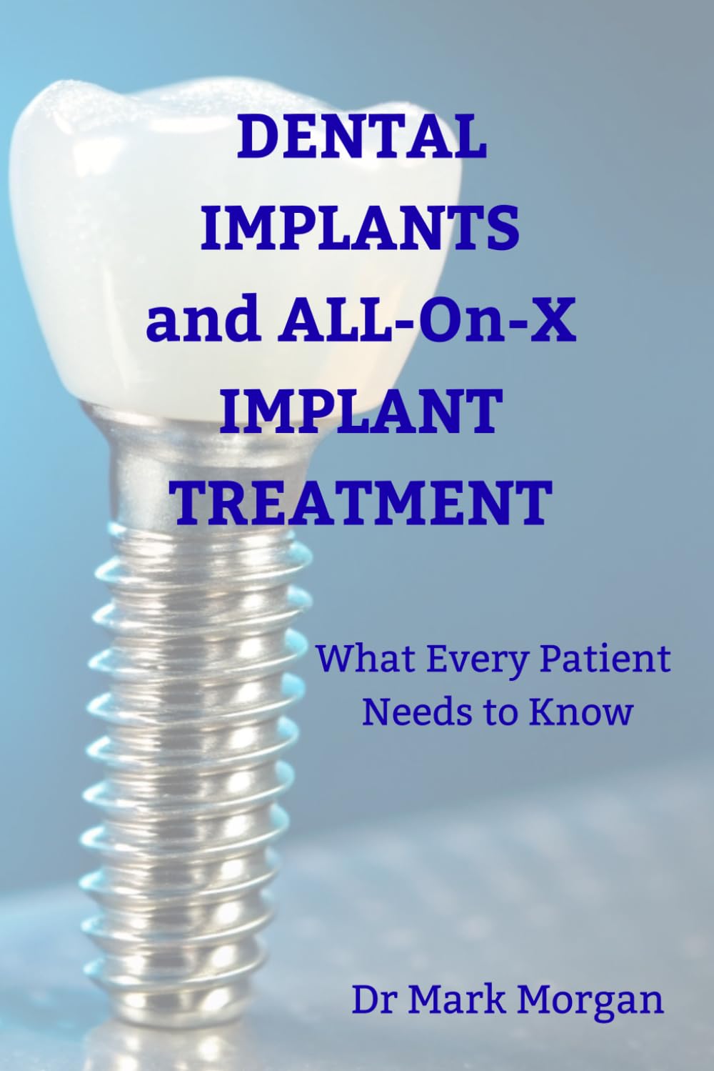 Dental Implants and ALL-on-X Implant Treatment: What Every Patient Needs to Know