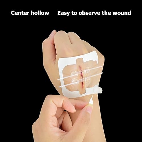 Miniatura 2 de Ayuda de banda con cremallera, dispositivo de cierre de heridas de emergencia de 2 piezas, protección de emergencia heridas de suturas de puntada