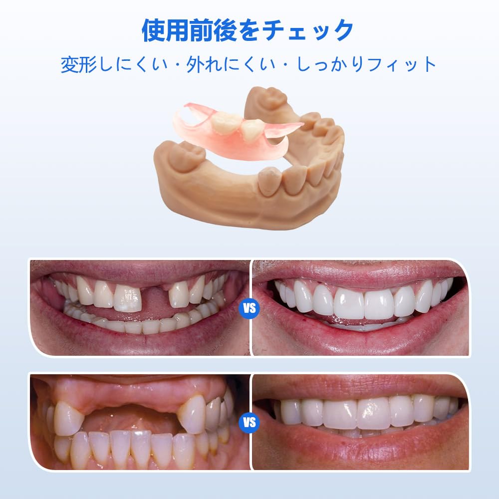 Amazon.co.jp: Dentellea 入れ歯 カスタム 義歯 部分いれば 取り外し