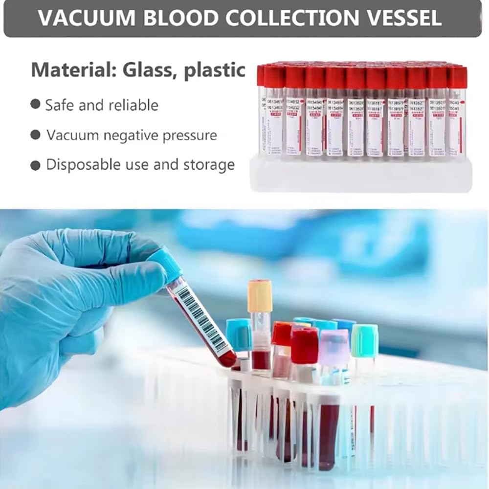 Provetta per Prelievo di Sangue Rosso,3Ml/5Ml/10Ml,Provette per Centrifuga,Provette per Prelievo di Sangue sotto Vuoto,Pressione Negativa,per Test di Laboratorio,Animali,100 Pezzi,5ml