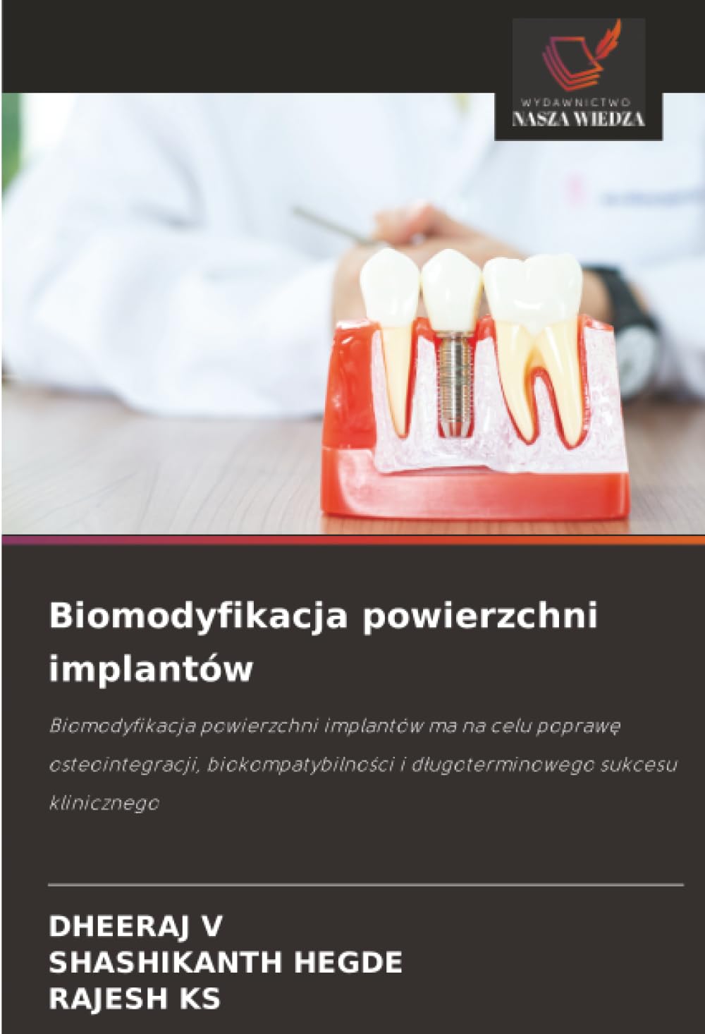 Biomodyfikacja powierzchni implantów: Biomodyfikacja powierzchni implantów ma na celu poprawę osteointegracji, biokompatybilności i długoterminowego sukcesu klinicznego