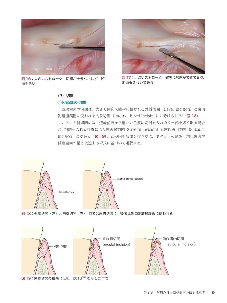 ゼロから見直す歯周外科治療 | 松延 允資 |本 | 通販 | Amazon