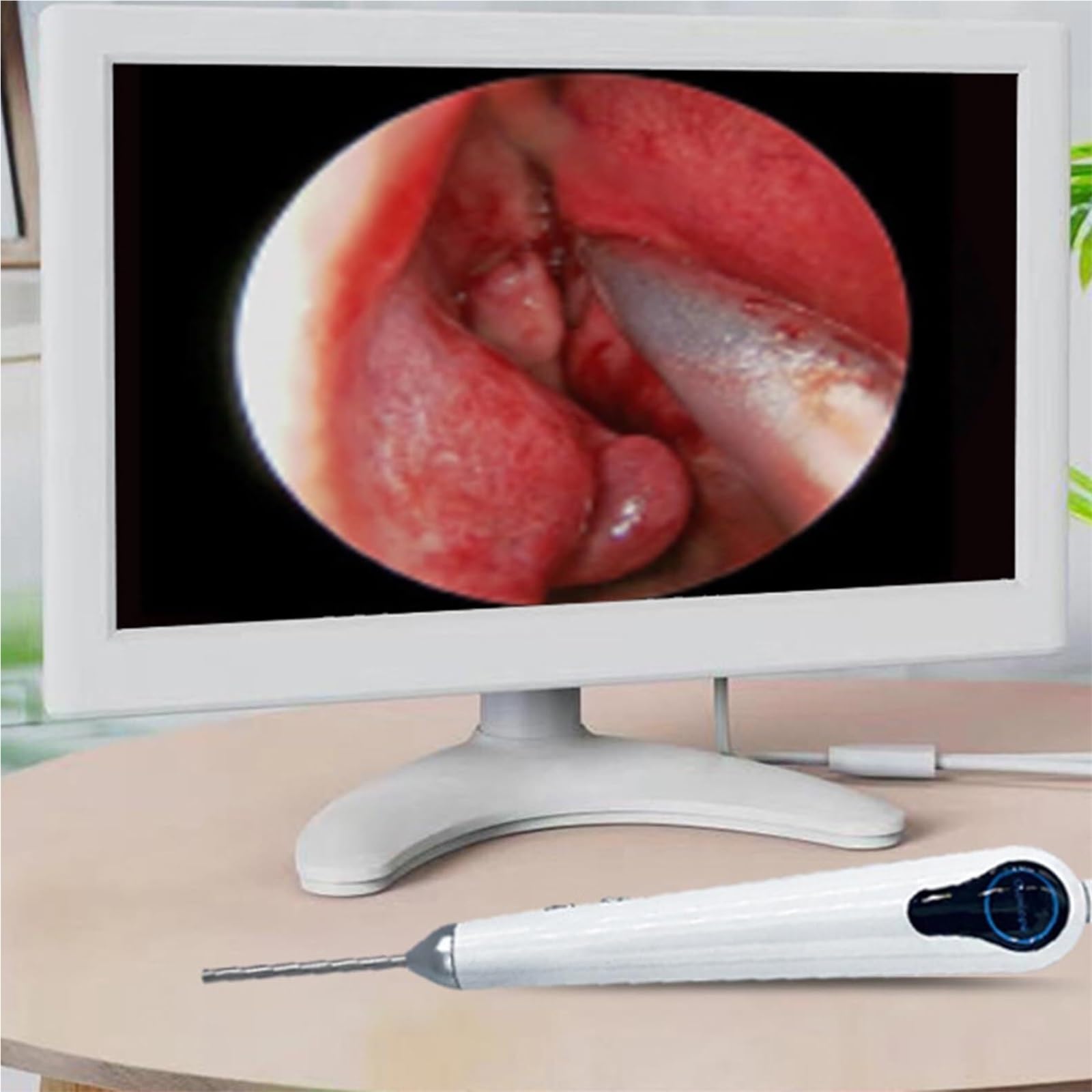 Herramienta digital de eliminación de cera for oídos, otoscopio visual HD de 3,2 mm con giroscopio y luz ajustable de 4 niveles, limpiador de oídos con cámara y pantalla for adultos