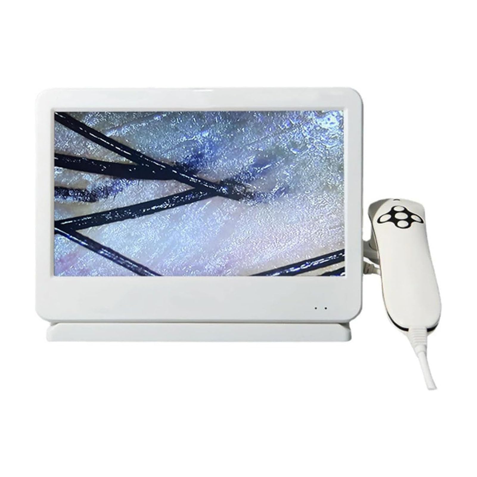 SenhE Analizzatore Cuoio Capelluto e Pelle 200X Display, HD 10,1 Pollici