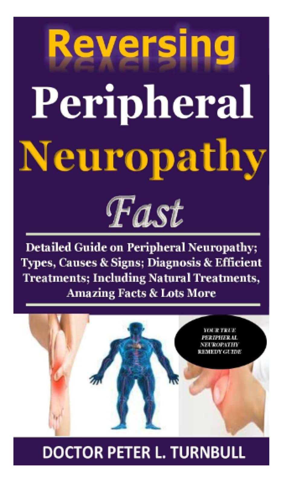 Reversing Peripheral Neuropathy Fast: Detailed Guide on Peripheral Neuropathy; Types, Causes & Signs; Diagnosis & Efficient Treatments; Including Natural Treatments, Amazing Facts & Lots More