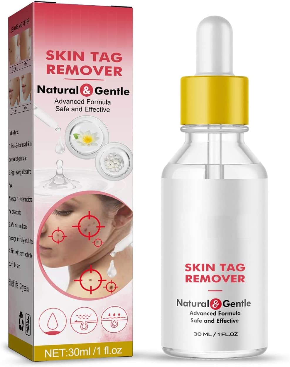 Super Luxe Skin Tag Remover,Super Luxe Tag Remover Mole & Skin Tag Corrector Serum,Safe & Effective, Fast-Acting Skin Tag Removal (1 Pcs)