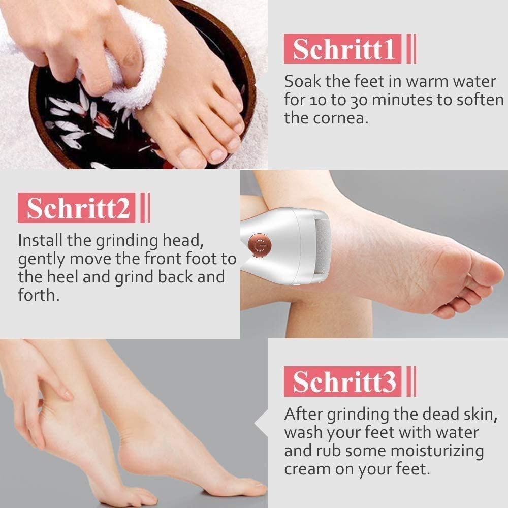 Piedi elettrici per la rimozione del callo Strumenti per Pedicure elettronici Portatili Ricaricabili Kit per la rimozione del callo Elettrico Cura dei Piedi Professionale Perfetto per duri